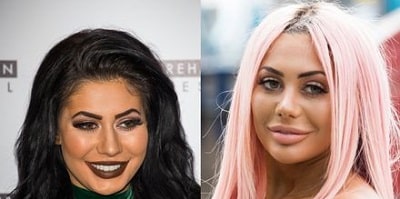 A picture of Chloe Ferry before (left) and after (right).
